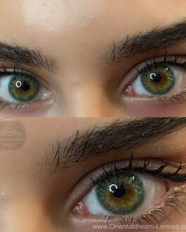 Medusa Green